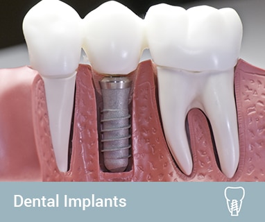 affordable dental implants gold coast