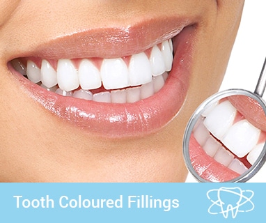 24+ Tooth Colored Fillings Near Me