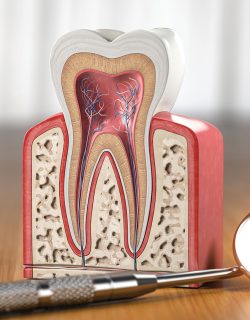 Services_Root-Canal.jpg