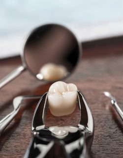 Services_Wisdom-Teeth.jpg